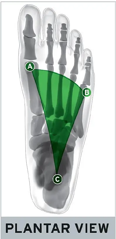 Chiropractic Mt Kisco NY Plantar Arch